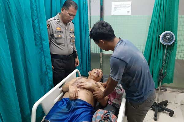 DIRAWAT: Iskandar (56) menjalani perawatan di Rumah Sakit Sembiring Delitua setelah dianiaya istrinya.