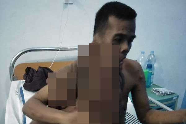 TUMOR: Kondisi Andriadi Putra yang menderita tumor seberat 30 Kg sebelum diopersi.