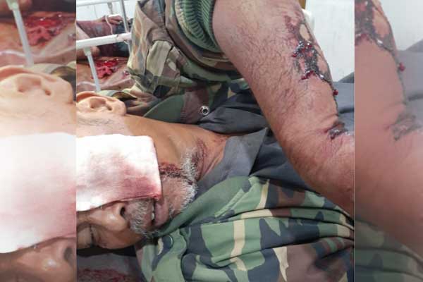 KORBAN: Salah satu korban yang menderita luka bacok.