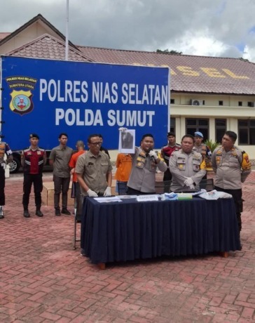 TUNJUK: AKBP Ferry Mulyana Sunarya menunjukkan hasil pemeriksaan medis terkait kondisi NN, bocah asal Nias Selatan yang viral karena diduga dianiaya.