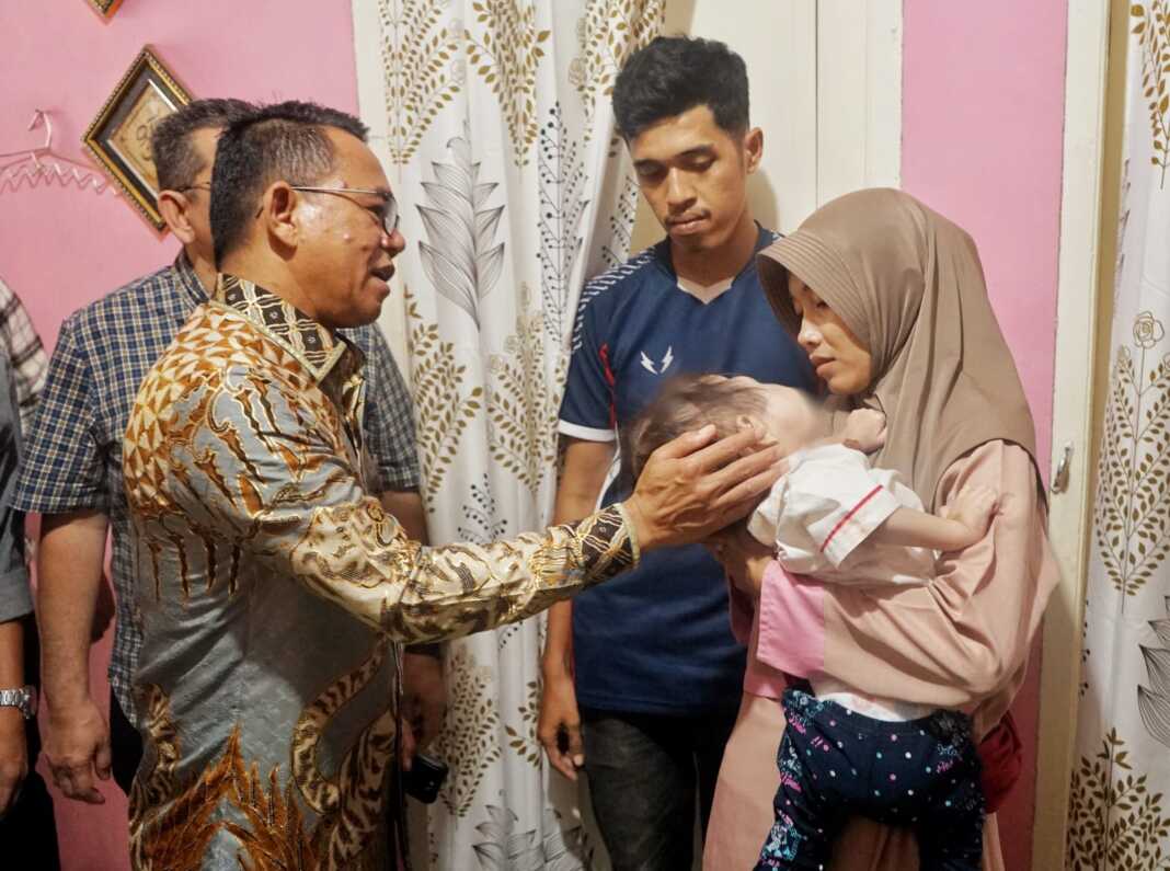 BANTU: Wakil Wali Kota Medan H. Zakiyuddin Harahap menjenguk Mikhayla, balita penderita kanker mata.