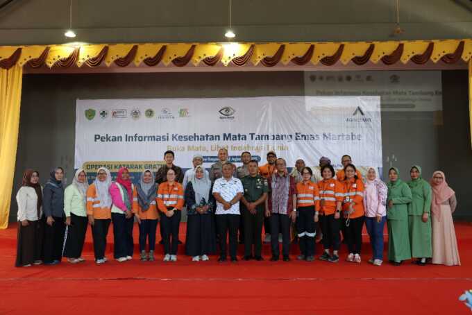 Agincourt Resources Kembali Gelar Operasi Katarak Gratis di 5 Lokasi